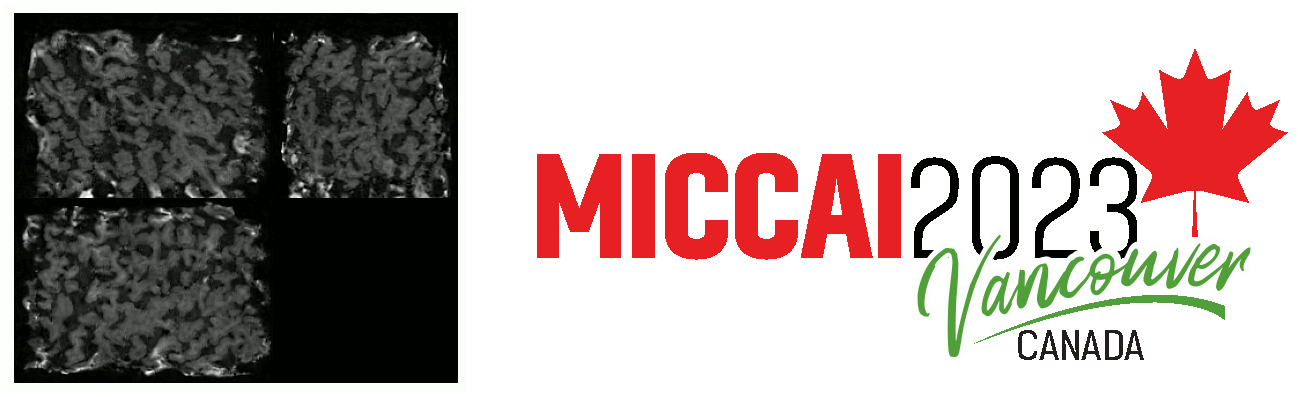 MICCAI 2023